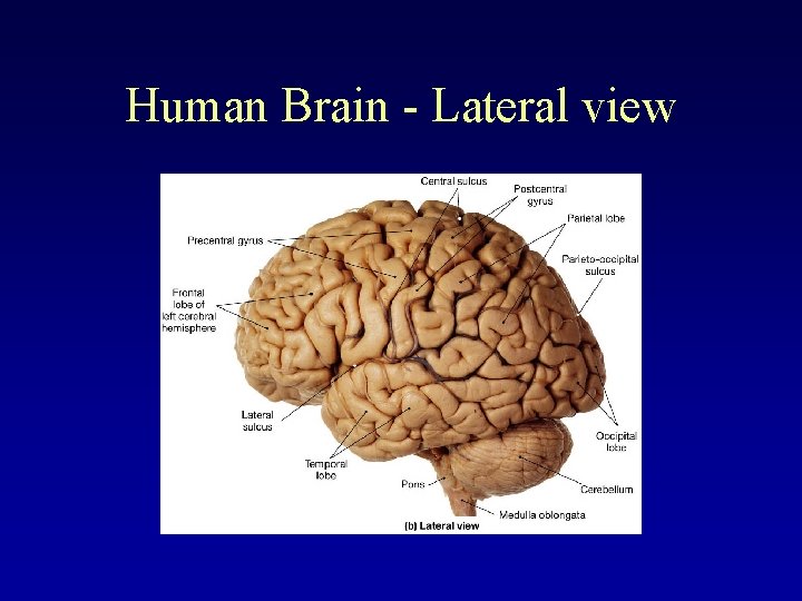 Human Brain - Lateral view 