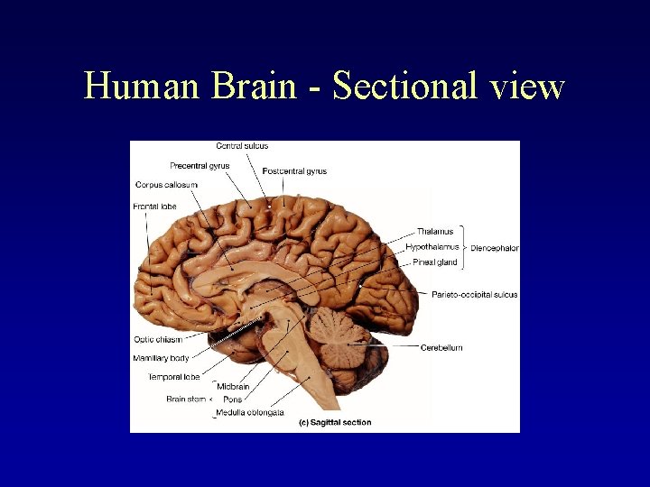 Human Brain - Sectional view 