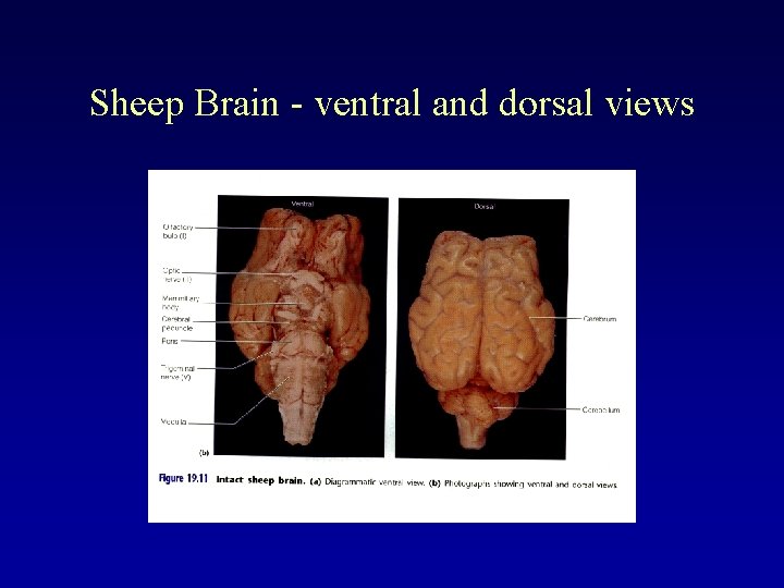 Sheep Brain - ventral and dorsal views 