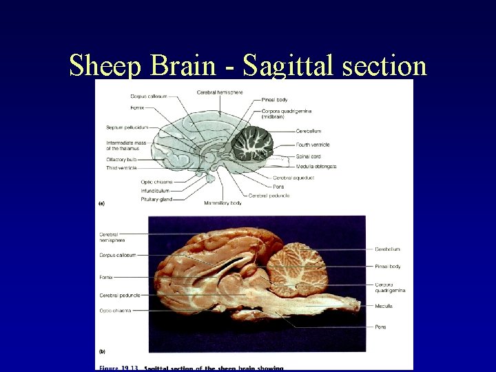 Sheep Brain - Sagittal section 