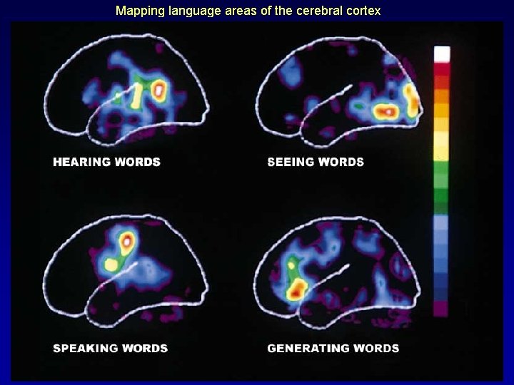 Mapping language areas of the cerebral cortex 