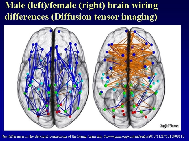 Male (left)/female (right) brain wiring differences (Diffusion tensor imaging) Sex differences in the structural