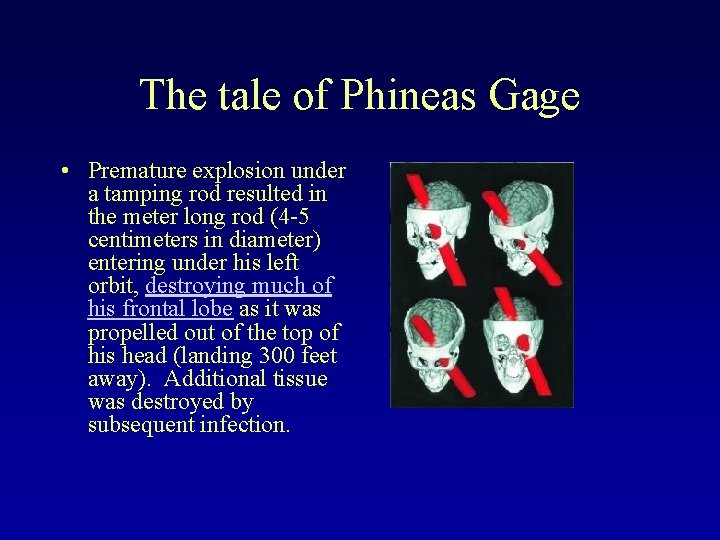 The tale of Phineas Gage • Premature explosion under a tamping rod resulted in