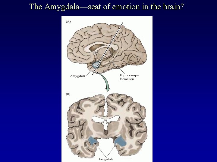 The Amygdala—seat of emotion in the brain? 