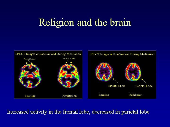 Religion and the brain Increased activity in the frontal lobe, decreased in parietal lobe