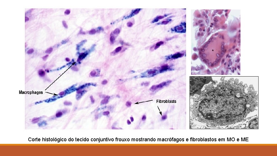 Corte histológico do tecido conjuntivo frouxo mostrando macrófagos e fibroblastos em MO e ME