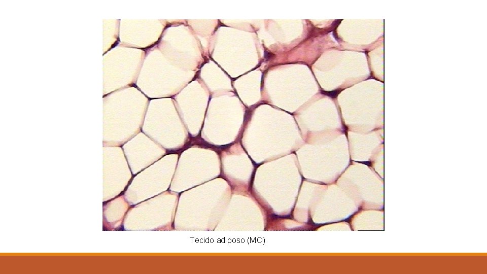 Tecido adiposo (MO) 