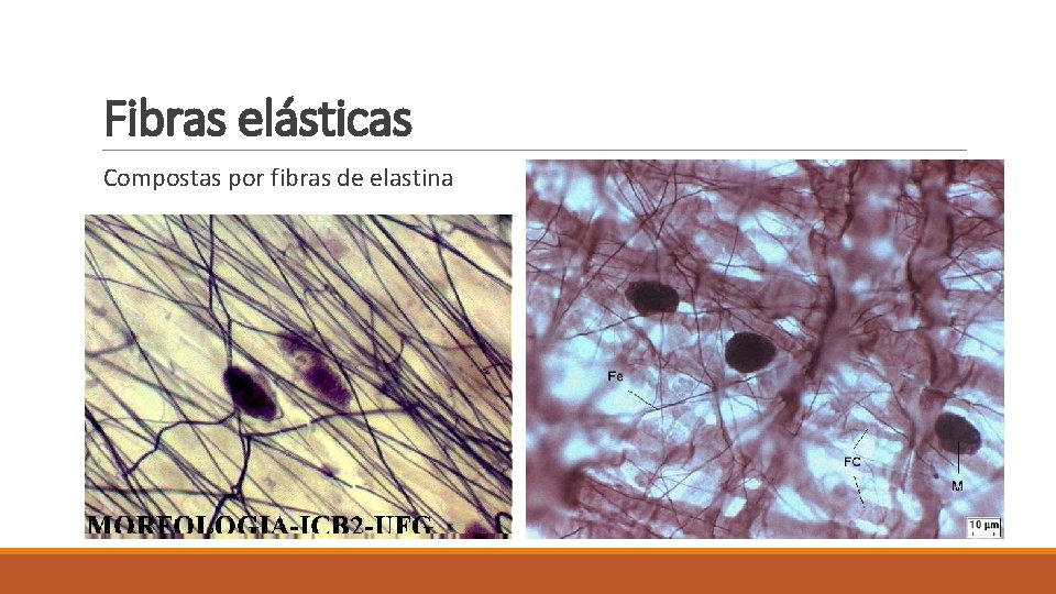 Fibras elásticas Compostas por fibras de elastina 
