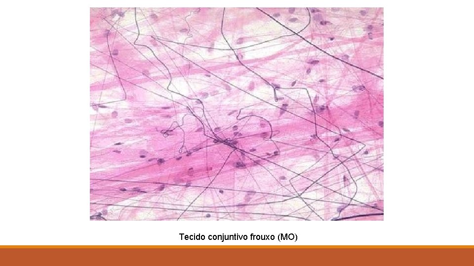 Tecido conjuntivo frouxo (MO) 