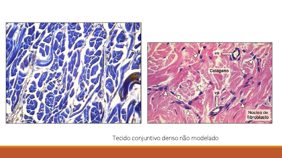 Tecido conjuntivo denso não modelado 