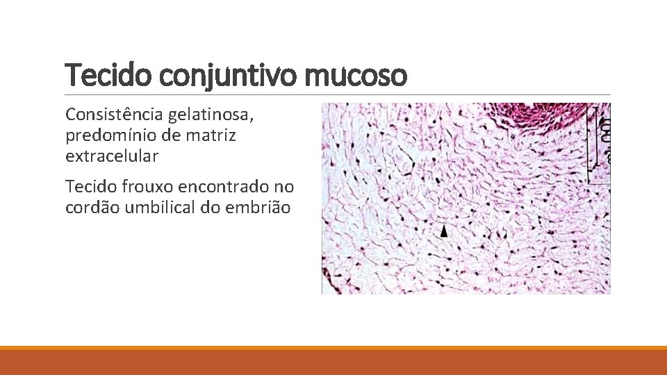Tecido conjuntivo mucoso Consistência gelatinosa, predomínio de matriz extracelular Tecido frouxo encontrado no cordão