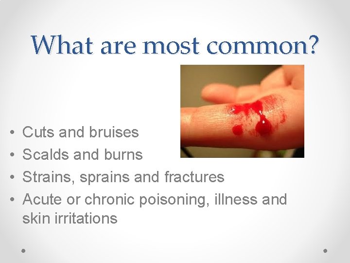 What are most common? • • Cuts and bruises Scalds and burns Strains, sprains