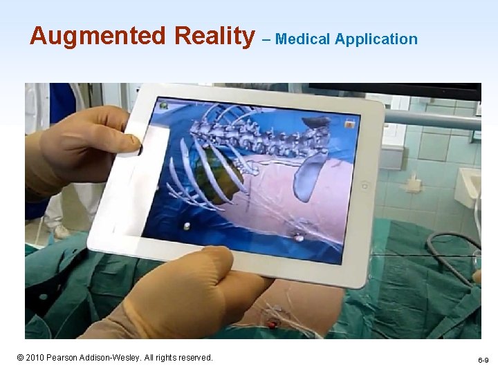 Augmented Reality – Medical Application 1 -9 © 2010 Pearson Addison-Wesley. All rights reserved.
