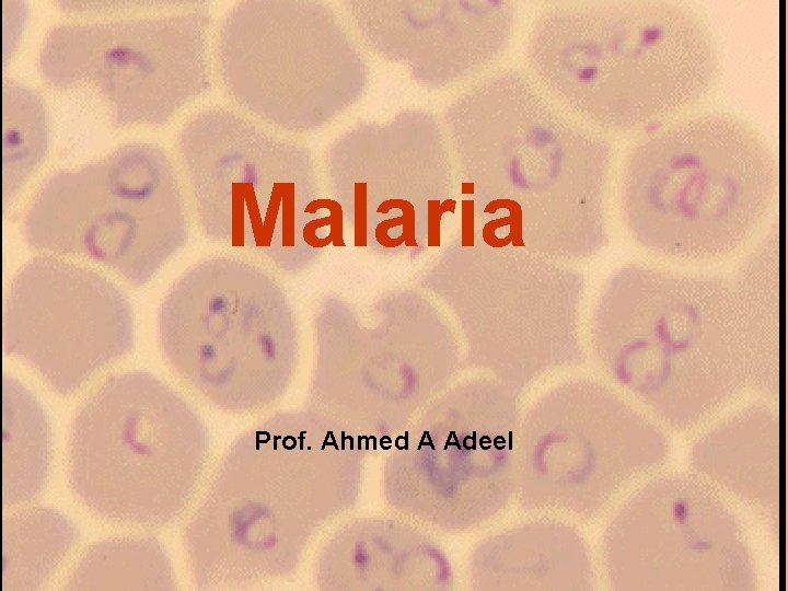 Malaria Prof. Ahmed A Adeel 