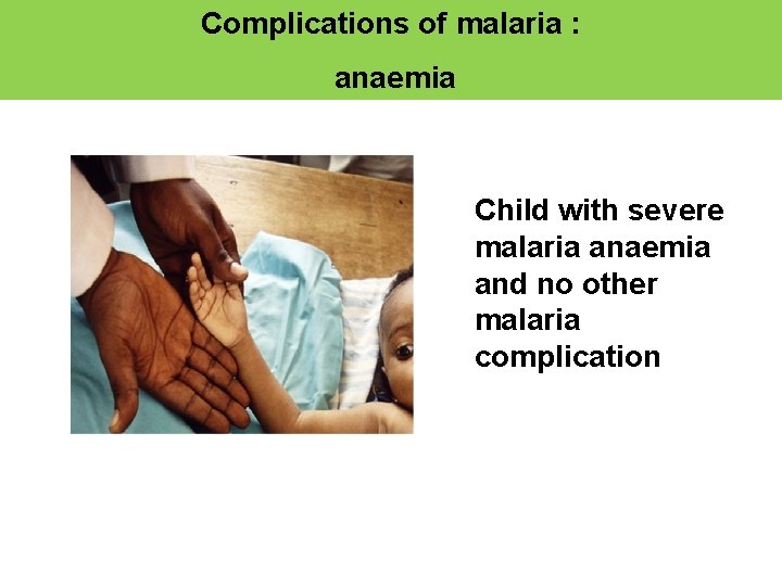 Complications of malaria : anaemia Child with severe malaria anaemia and no other malaria