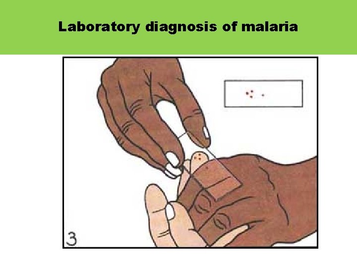 Laboratory diagnosis of malaria 