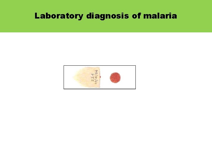 Laboratory diagnosis of malaria 