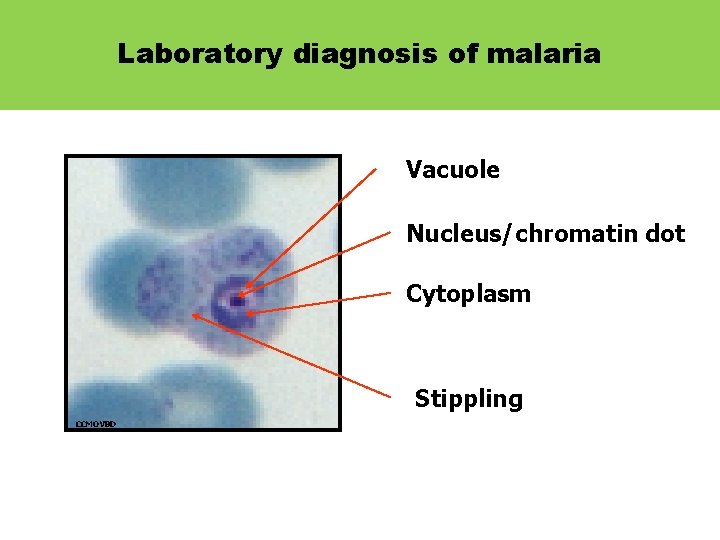 Laboratory diagnosis of malaria Features of Plasmodium Vacuole Nucleus/chromatin dot Cytoplasm Stippling CCMOVBD 