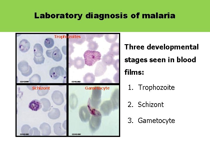 Laboratory diagnosis of malaria The Malaria Parasite Trophozoites Three developmental stages seen in blood