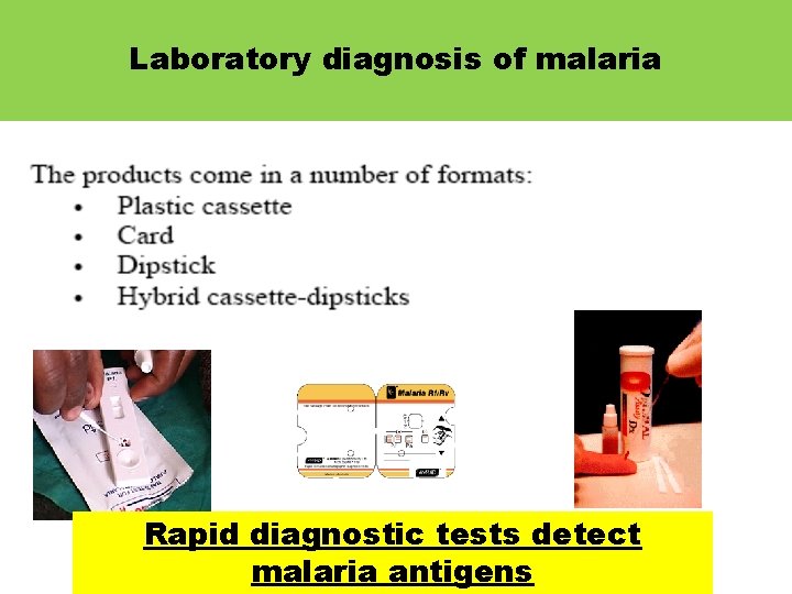 Laboratory diagnosis of malaria Rapid diagnostic tests detect malaria antigens 