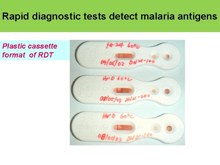 Rapid diagnostic tests detect malaria antigens Plastic cassette format of RDT 