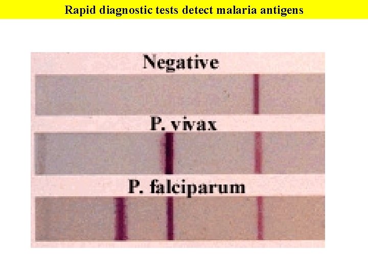 Rapid diagnostic tests detect malaria antigens 