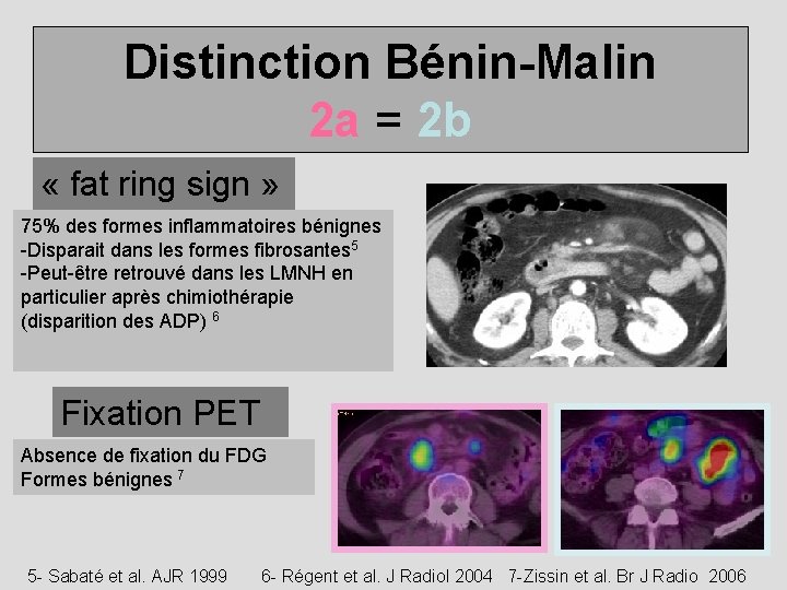 Distinction Bénin-Malin 2 a = 2 b « fat ring sign » 75% des