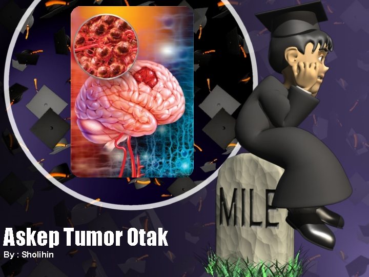 Askep Tumor Otak By : Sholihin 
