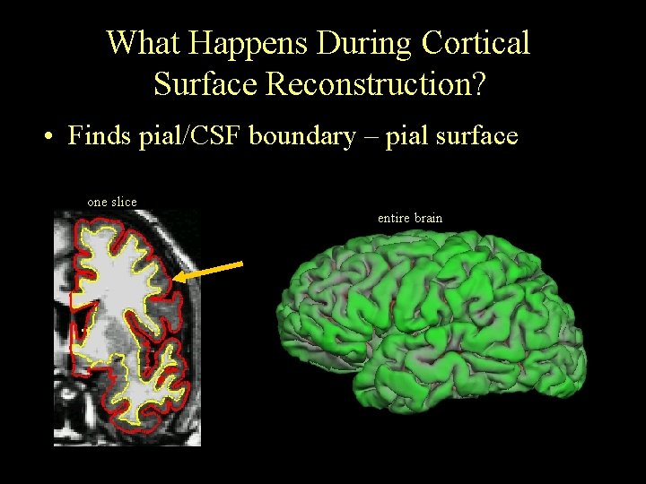 What Happens During Cortical Surface Reconstruction? • Finds pial/CSF boundary – pial surface one