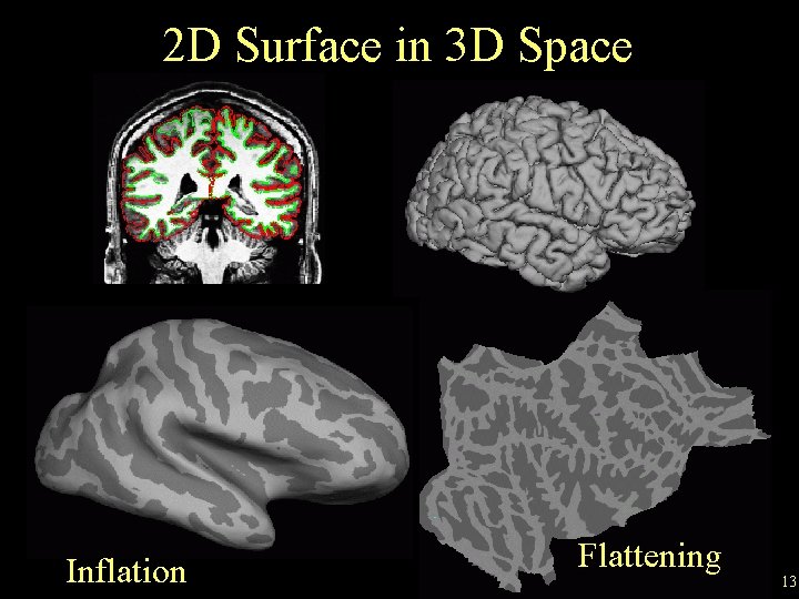 2 D Surface in 3 D Space Inflation Flattening 13 