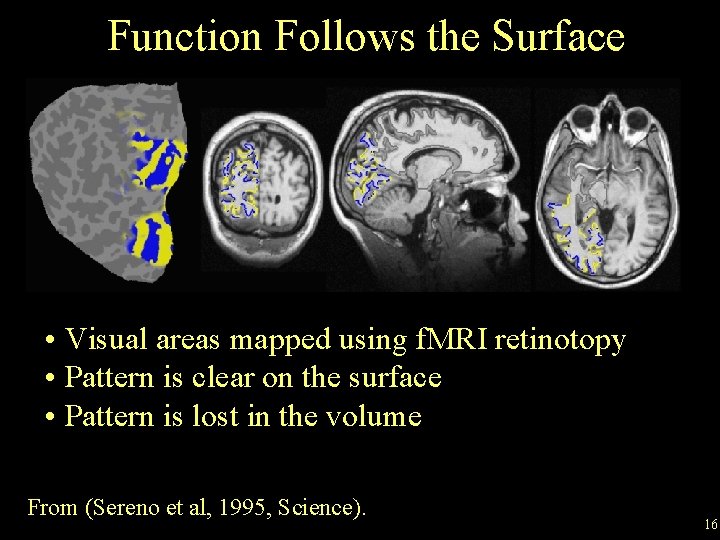 Function Follows the Surface • Visual areas mapped using f. MRI retinotopy • Pattern