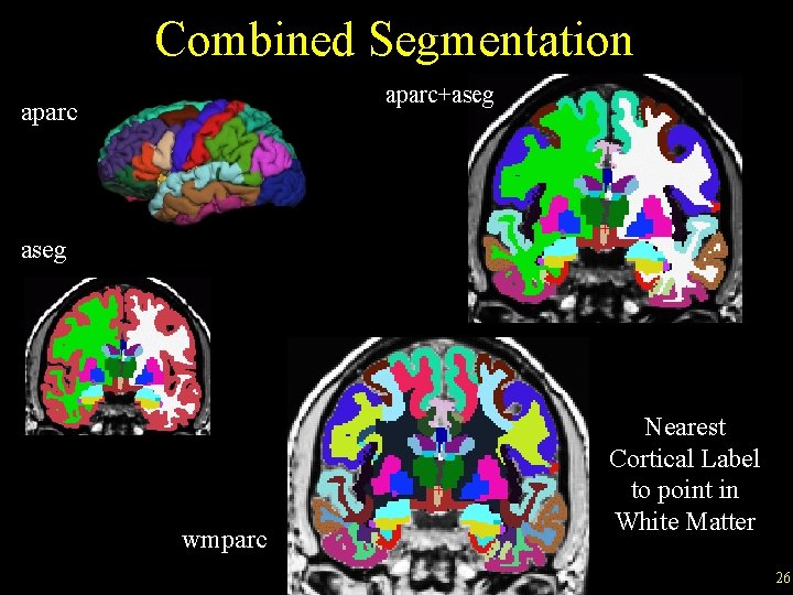 Combined Segmentation aparc+aseg aparc aseg wmparc Nearest Cortical Label to point in White Matter