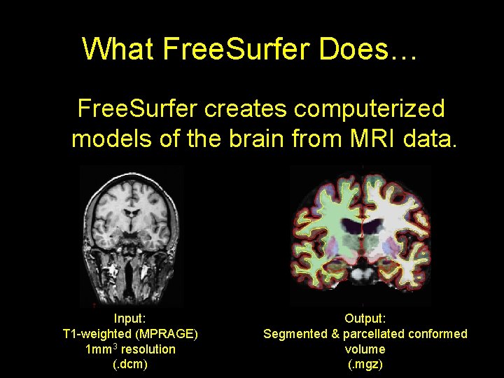 What Free. Surfer Does… Free. Surfer creates computerized models of the brain from MRI