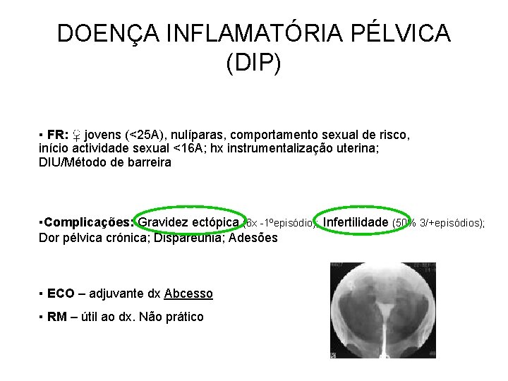 DOENÇA INFLAMATÓRIA PÉLVICA (DIP) ▪ FR: ♀ jovens (<25 A), nulíparas, comportamento sexual de DOENÇA INFLAMATÓRIA PÉLVICA (DIP) ▪ FR: ♀ jovens (<25 A), nulíparas, comportamento sexual de