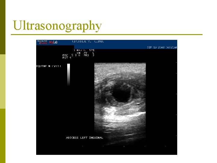 Ultrasonography 