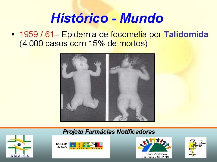 Histórico - Mundo § 1959 / 61– Epidemia de focomelia por Talidomida (4. 000