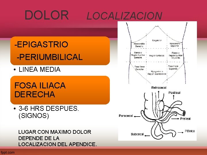 DOLOR LOCALIZACION -EPIGASTRIO -PERIUMBILICAL • LINEA MEDIA FOSA ILIACA DERECHA • 3 -6 HRS