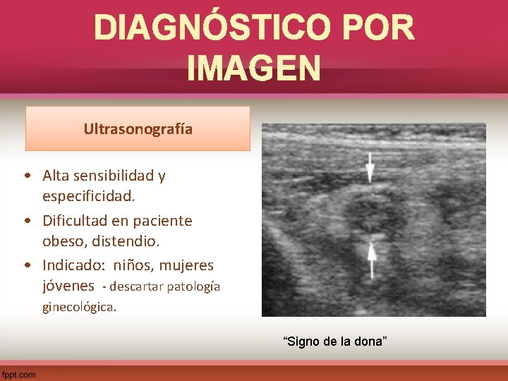 DIAGNÓSTICO POR IMAGEN Ultrasonografía • Alta sensibilidad y especificidad. • Dificultad en paciente obeso,