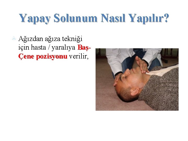 Yapay Solunum Nasıl Yapılır? Ağızdan ağıza tekniği için hasta / yaralıya BaşÇene pozisyonu verilir,