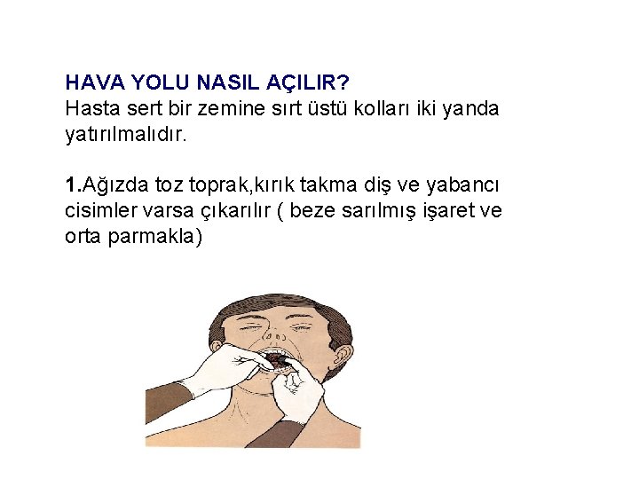 HAVA YOLU NASIL AÇILIR? Hasta sert bir zemine sırt üstü kolları iki yanda yatırılmalıdır.