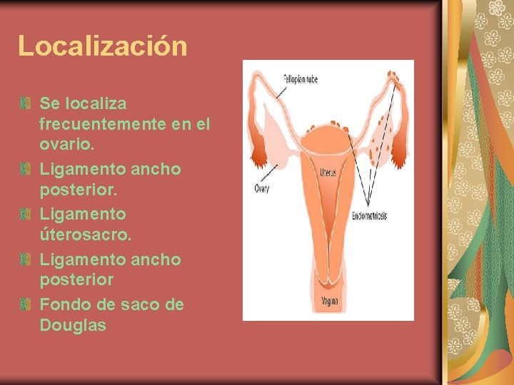 Localización Se localiza frecuentemente en el ovario. Ligamento ancho posterior. Ligamento úterosacro. Ligamento ancho