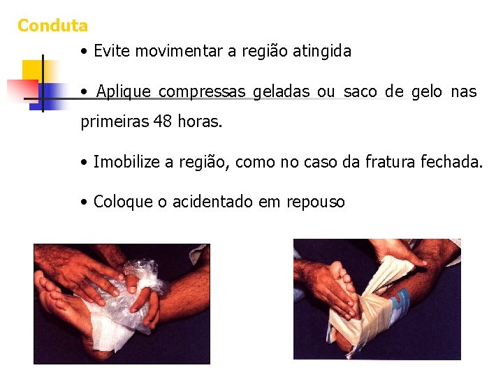 Conduta • Evite movimentar a região atingida • Aplique compressas geladas ou saco de