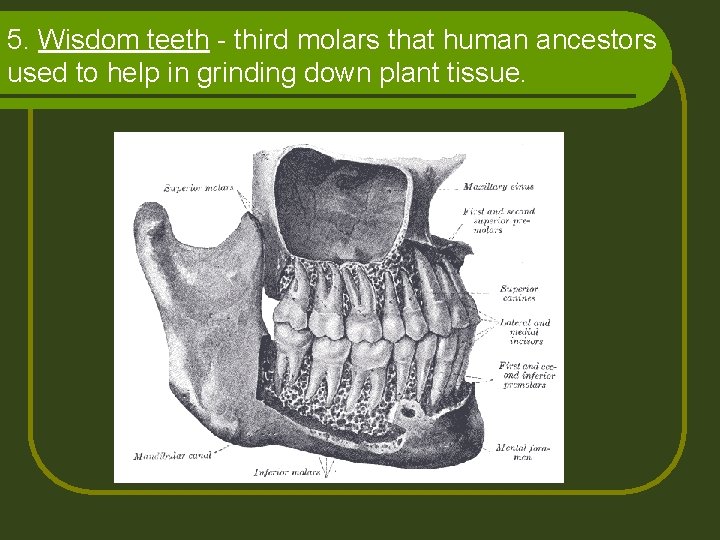 5. Wisdom teeth - third molars that human ancestors used to help in grinding