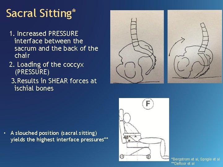 Sacral Sitting* 1. Increased PRESSURE interface between the sacrum and the back of the