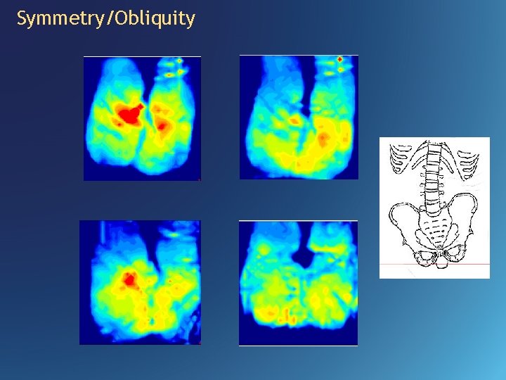 Symmetry/Obliquity 