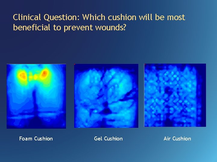 Clinical Question: Which cushion will be most beneficial to prevent wounds? Foam Cushion Gel