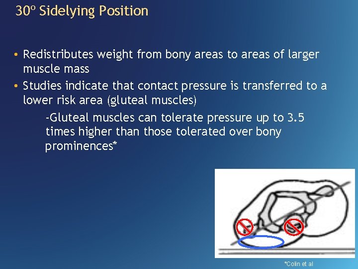 30º Sidelying Position • Redistributes weight from bony areas to areas of larger muscle