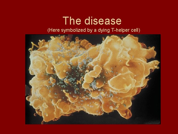 The disease (Here symbolized by a dying T-helper cell) 