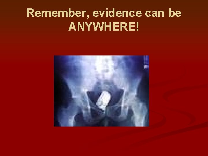 Remember, evidence can be ANYWHERE! 