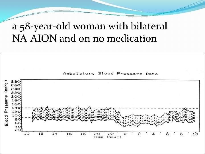 a 58 -year-old woman with bilateral NA-AION and on no medication 